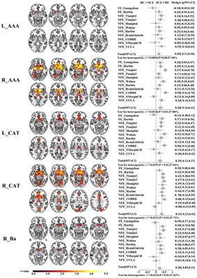 Selective disrupted gray matter volume covariance of amygdala subregions in schizophrenia